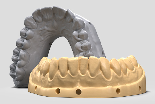 application-dental-resin-FastDentalModel.jpg