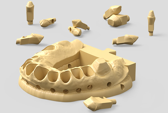 application-dental-resin-HighPrecisionDentalModel.jpg
