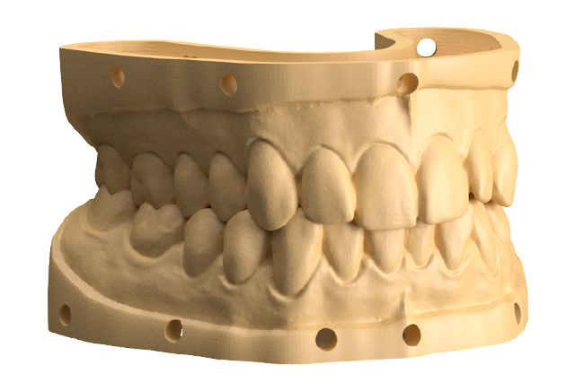 FastDentalModel.png